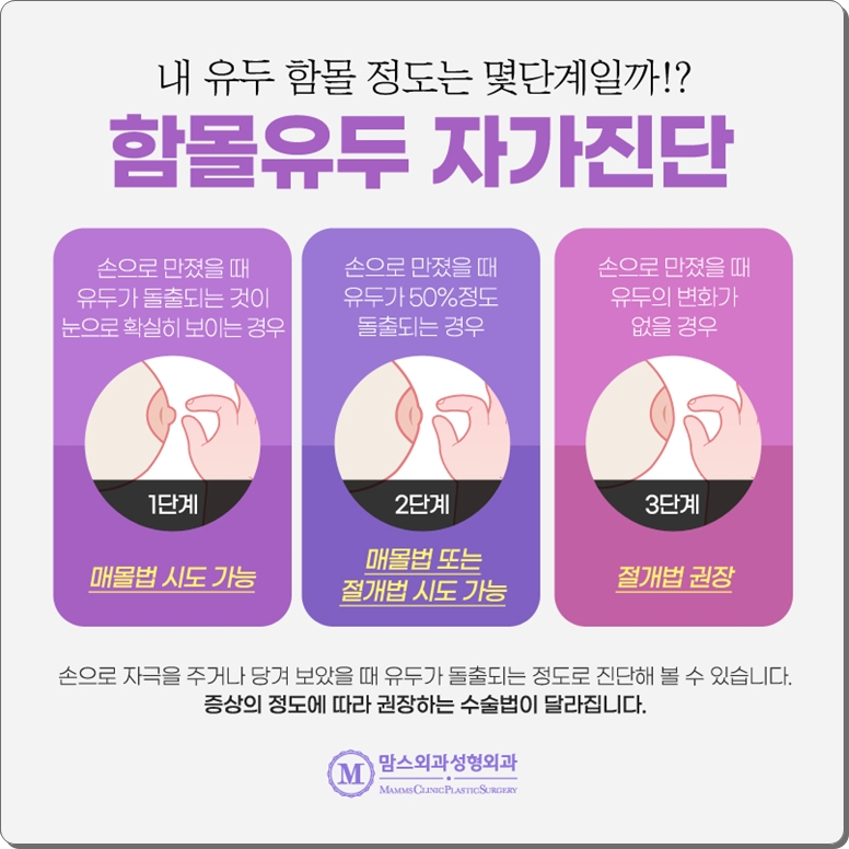 함몰유두교정 수술도 주의 깊게 살펴보면 관련 이미지 7