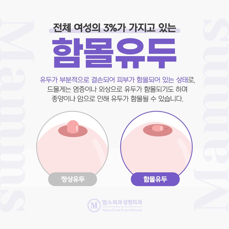 편평유두수술 컴플렉스 자연스럽게 개선 가능! 관련 이미지 3