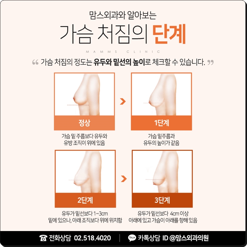 가슴처짐수술 깊은 고민 속에서 관련 이미지 5
