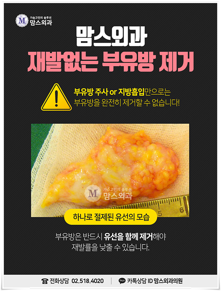 부유방제거 걱정만 했었는데 관련 이미지 5