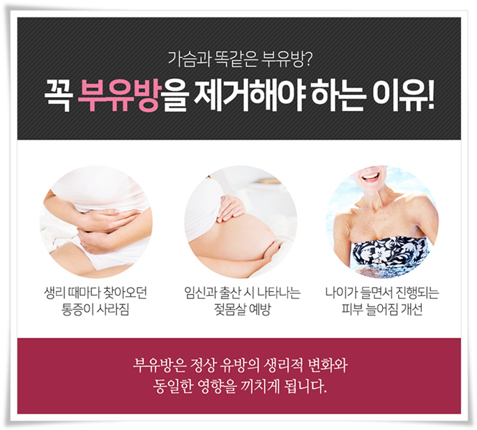 부유방수술 평소에 신경이 쓰였다면 관련 이미지 5