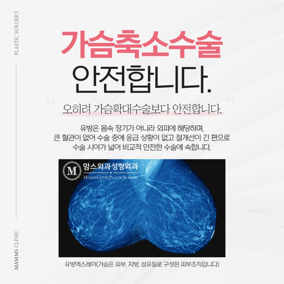 유방축소술 개인의 체형에 맞게! 관련 이미지 2