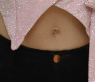 If You Want to Change Naturally Without Worrying About Scars from Breast Reduction Surgery image 25