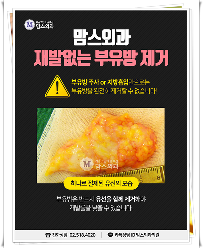 겨드랑이부유방 튀어나와 있다면? 관련 이미지 5
