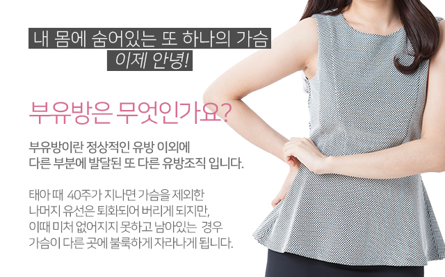 부유방제거수술 믿을수있는곳에서 관련 이미지 2