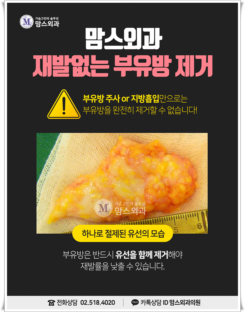 부유방살빼기 가능할까요? 관련 이미지 6