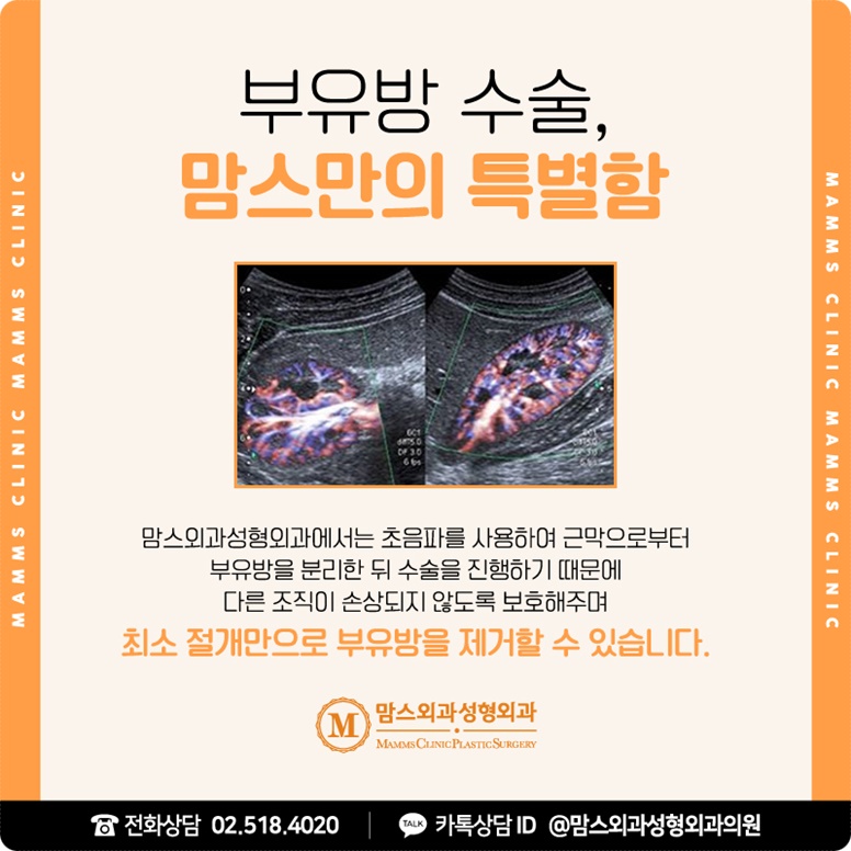 겨드랑이유선 깨끗하게 관련 이미지 7