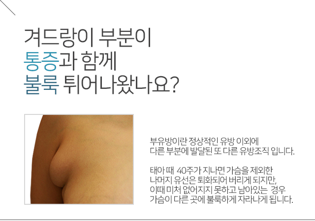 겨드랑이부유방제거 원인을찾아서 관련 이미지 2