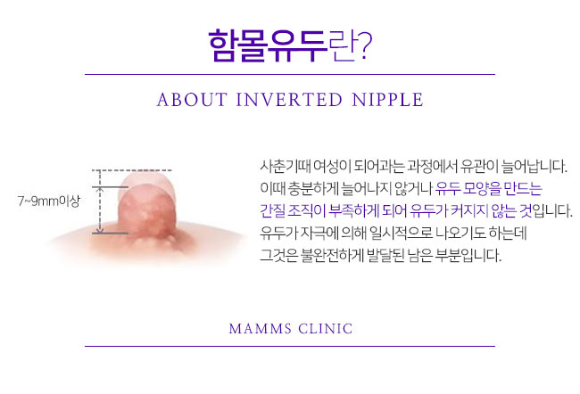 함몰유두수술 단계별로 관련 이미지 2