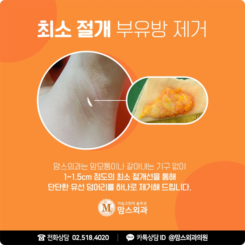 겨드랑이 멍울 자국 걱정 없이 깔끔하게! 관련 이미지 5
