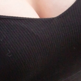 Breast Sagging Surgery to Regain Firmness image 19