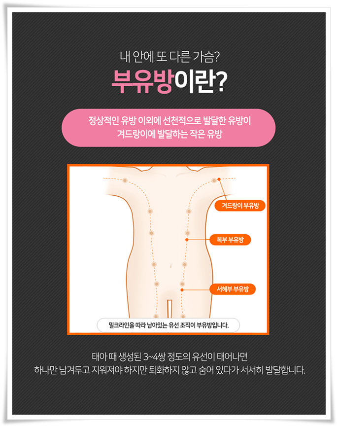 부유방수술 평소에 신경이 쓰였다면 관련 이미지 3