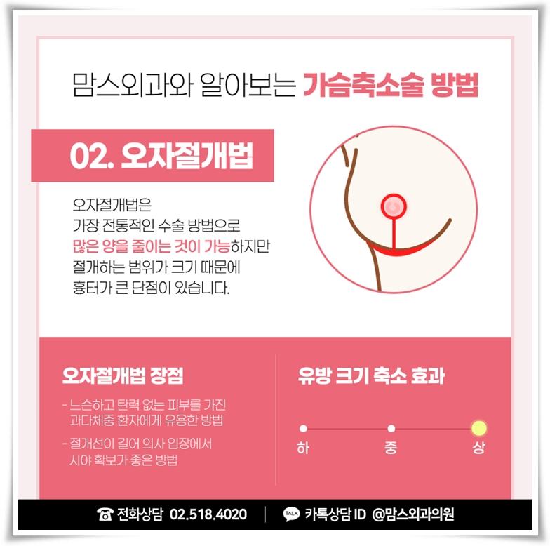 거대유방수술 아름다움과 편안함을 원한다면 관련 이미지 7