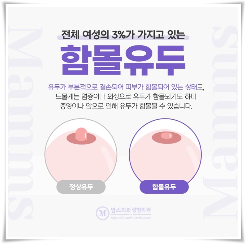함몰유두수술병원, 찾아가려 할 때 관련 이미지 2