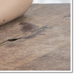 Breast Reduction Surgery from a Different Perspective image 24