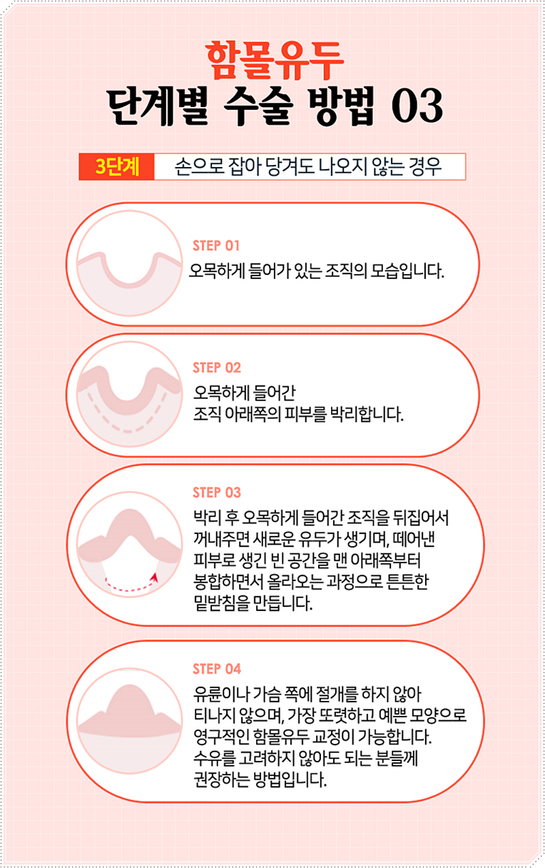유두모양 사람에 따라 다르죠! 관련 이미지 8