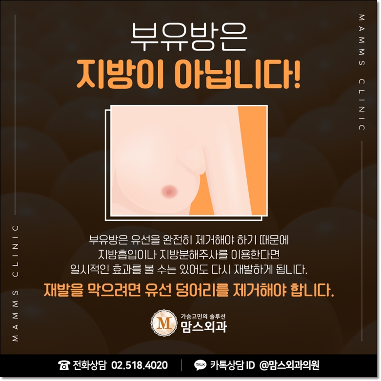 겨드랑이지방흡입 고려한다면 관련 이미지 3