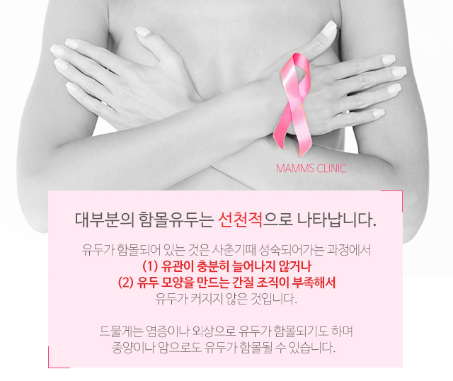 함몰유두유방암 연관있을까 관련 이미지 2