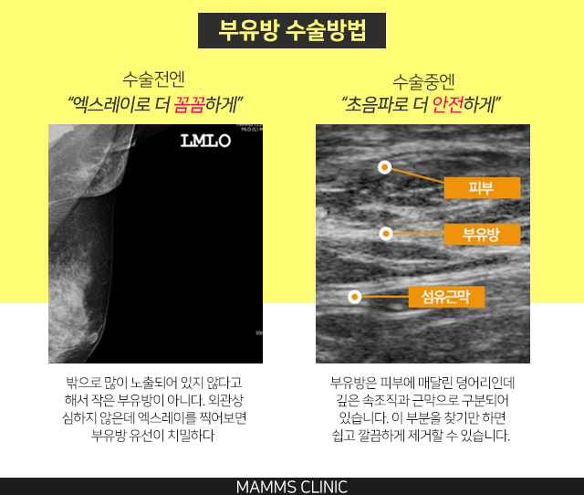 부유방마사지 효과없다면 관련 이미지 3