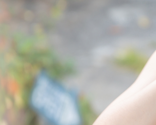 If You Want Clean and Smooth Breast Reduction Scars image 16