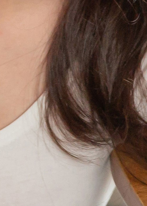 겨드랑이유선 깨끗하게 관련 이미지 19