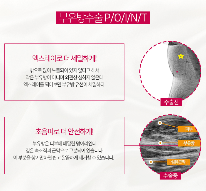 겨드랑이 살빼기 잘안될때 관련 이미지 5