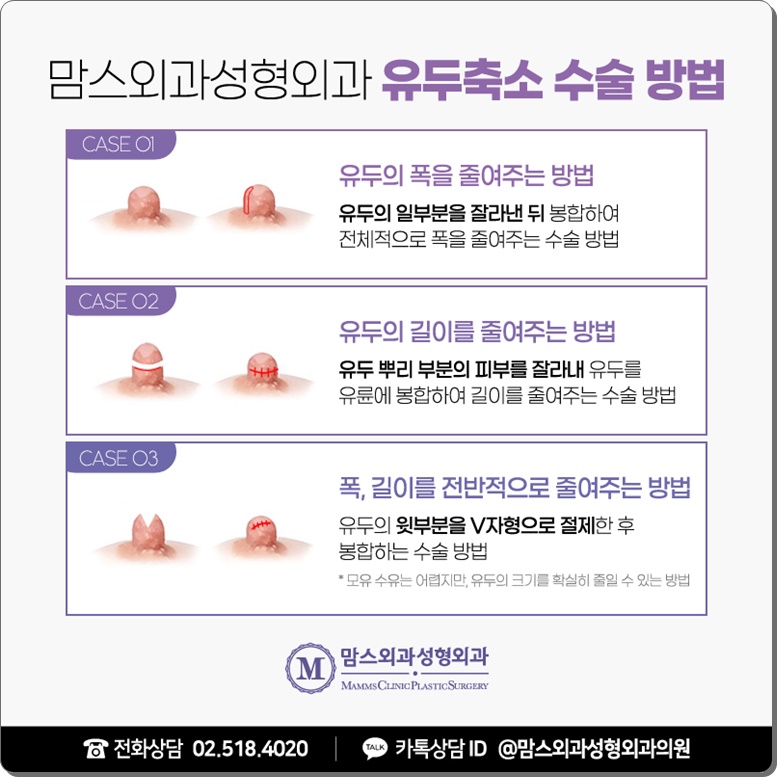 유륜축소 , 행복을 위해 관련 이미지 6