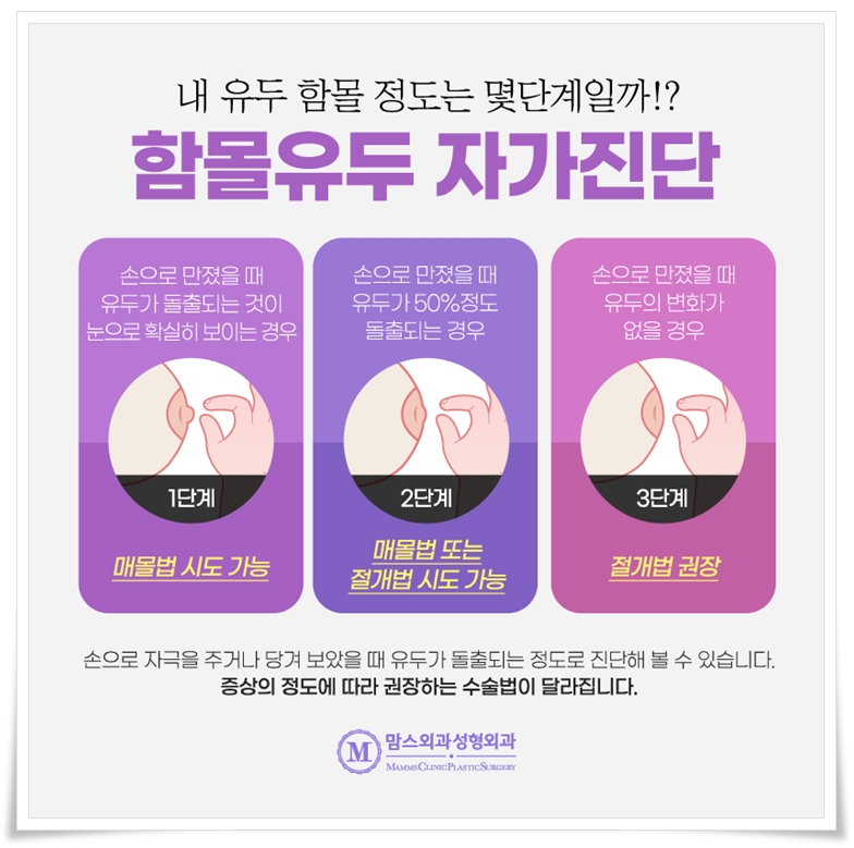 함몰유두교정 수술, 제대로 알기 관련 이미지 7