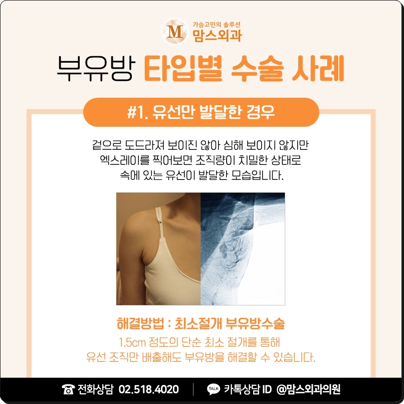 부유방수술병원 당당함을 원한다면 관련 이미지 5