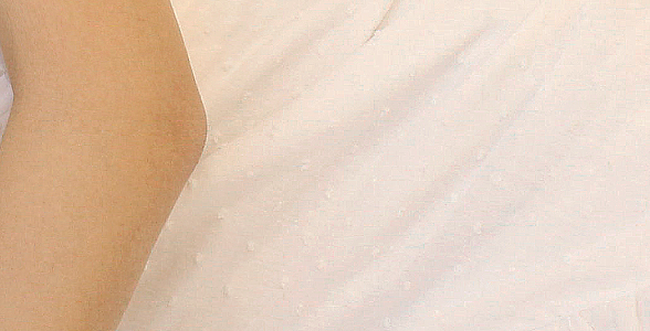Safe Axillary Accessory Breast Removal Surgery with the Touch of a Breast Surgery Specialist! image 22