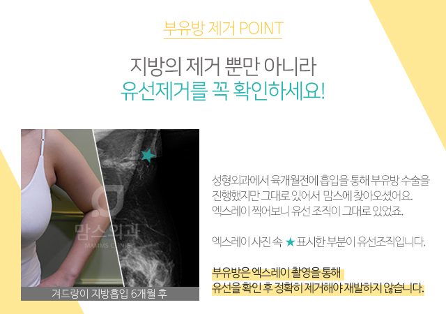 겨드랑이통증 느껴지시나요? 관련 이미지 3