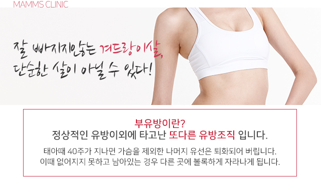 겨드랑이살빼기 잘안된다면 관련 이미지 2