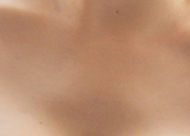 Breast Reduction O-Z Incision, Beautifully Enhanced with Even the Smallest Details image 20