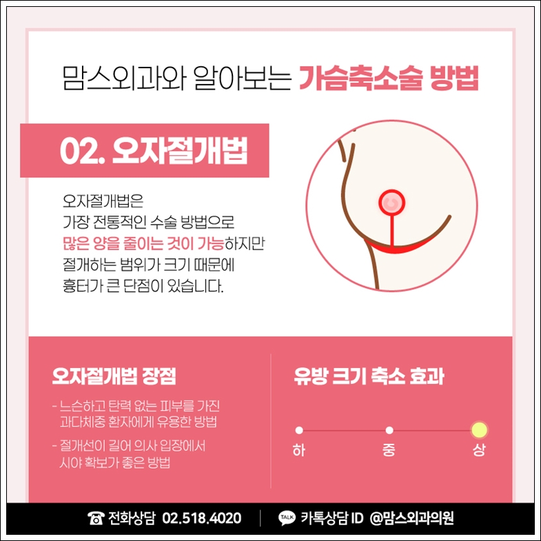 가슴축소술 흉터, 심하지 않게 관련 이미지 7