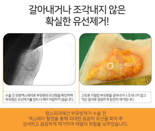 오른쪽겨드랑이통증 주기적으로 느껴진다면 관련 이미지 3