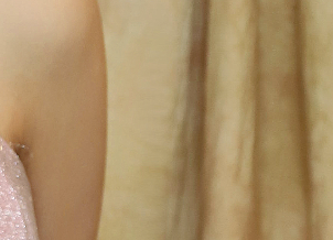 겨드랑이살 볼륨 줄이고 슬림한 라인을 원한다면? 관련 이미지 18