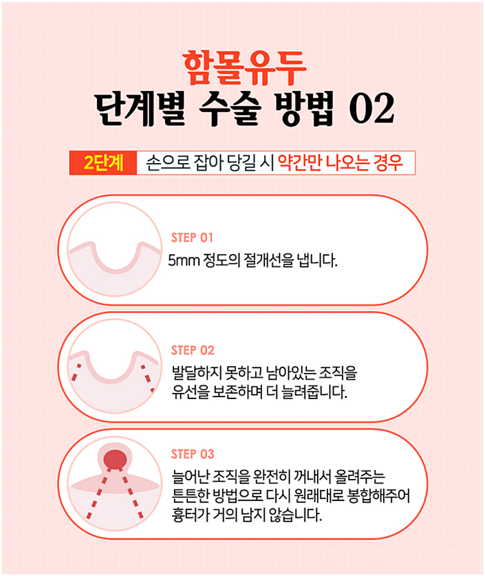 유두성형 더 당당해질 수 있지 관련 이미지 6
