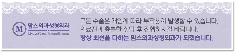 뱃살지방흡입 이럴 때도 추천한다? 관련 이미지 15