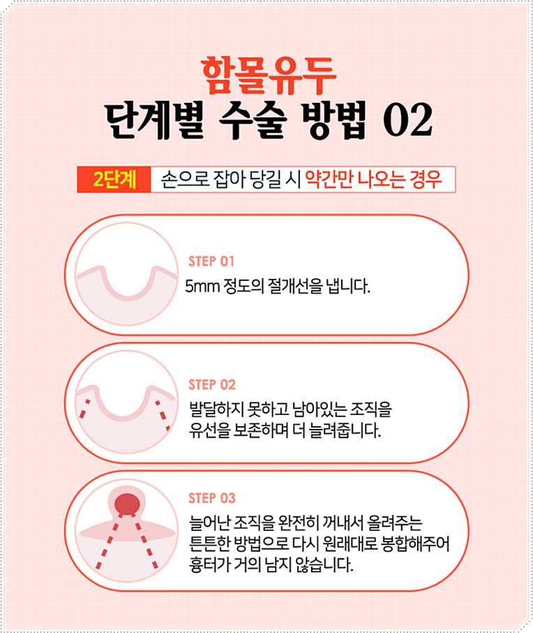유두모양 사람에 따라 다르죠! 관련 이미지 7