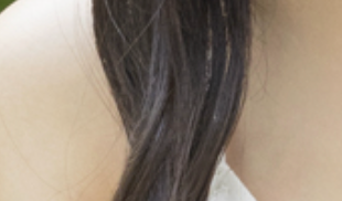 함몰유두병원 개인 맞춤형 치료가 필요한 이유? 관련 이미지 16