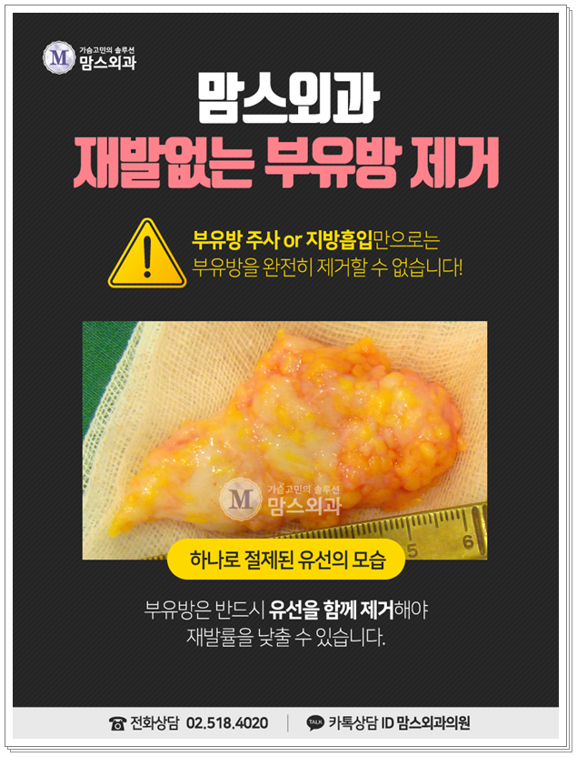 부유방빼기 하루에 가능 했다니 관련 이미지 8