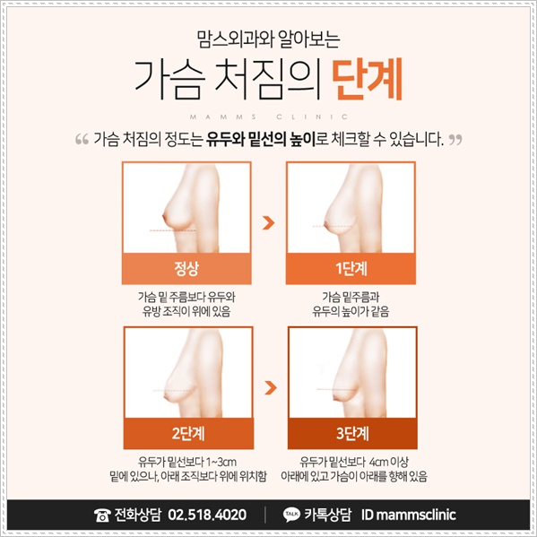 처진가슴수술비용 찾고 찾아서 관련 이미지 3