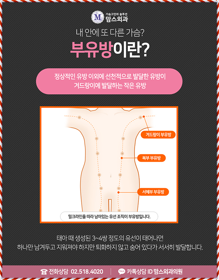 부유방수술 더 예쁜 라인을 위해! 관련 이미지 3