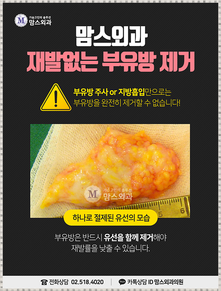 겨드랑이부유방제거 혼자선 안되니까~ 관련 이미지 5