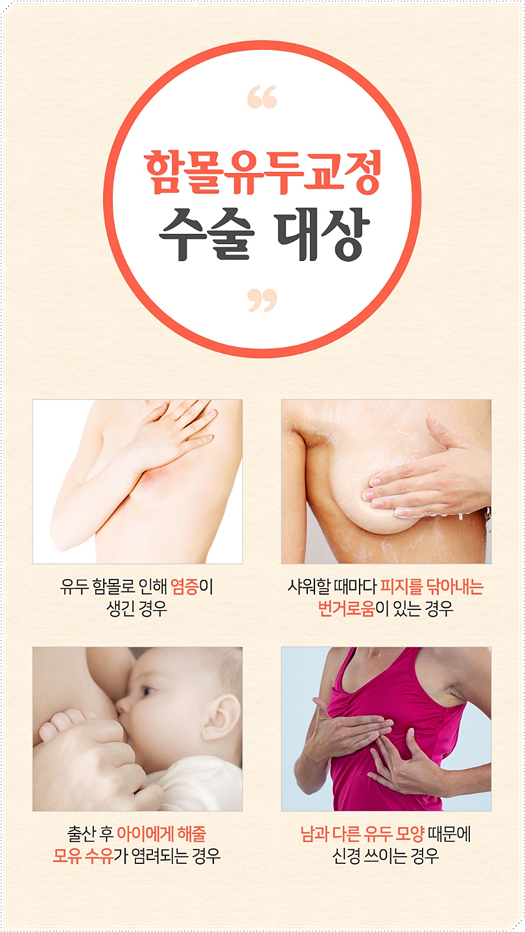 유두모양 사람에 따라 다르죠! 관련 이미지 4