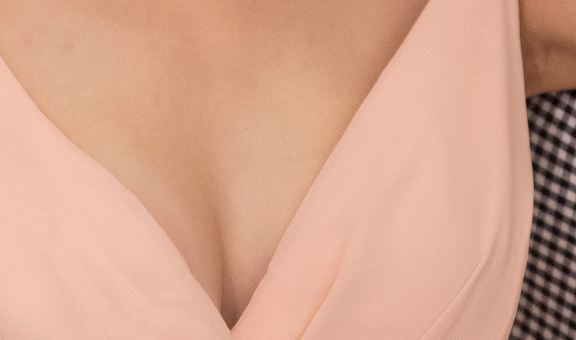 가슴축소수술가격 만족스러운 비용과 프리미엄 관리를 한 번에? 관련 이미지 21
