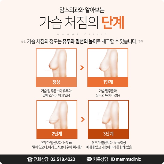 처진가슴올리기 어려움 없도록 관련 이미지 4