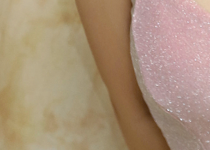겨드랑이살 볼륨 줄이고 슬림한 라인을 원한다면? 관련 이미지 19