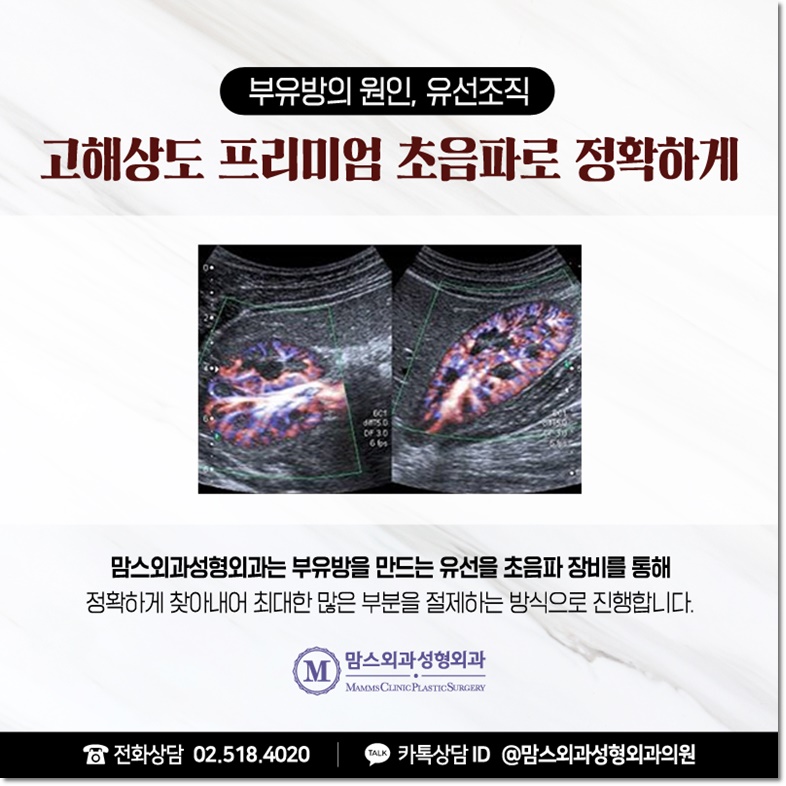 부유방수술후기 나를 위한 관련 이미지 8
