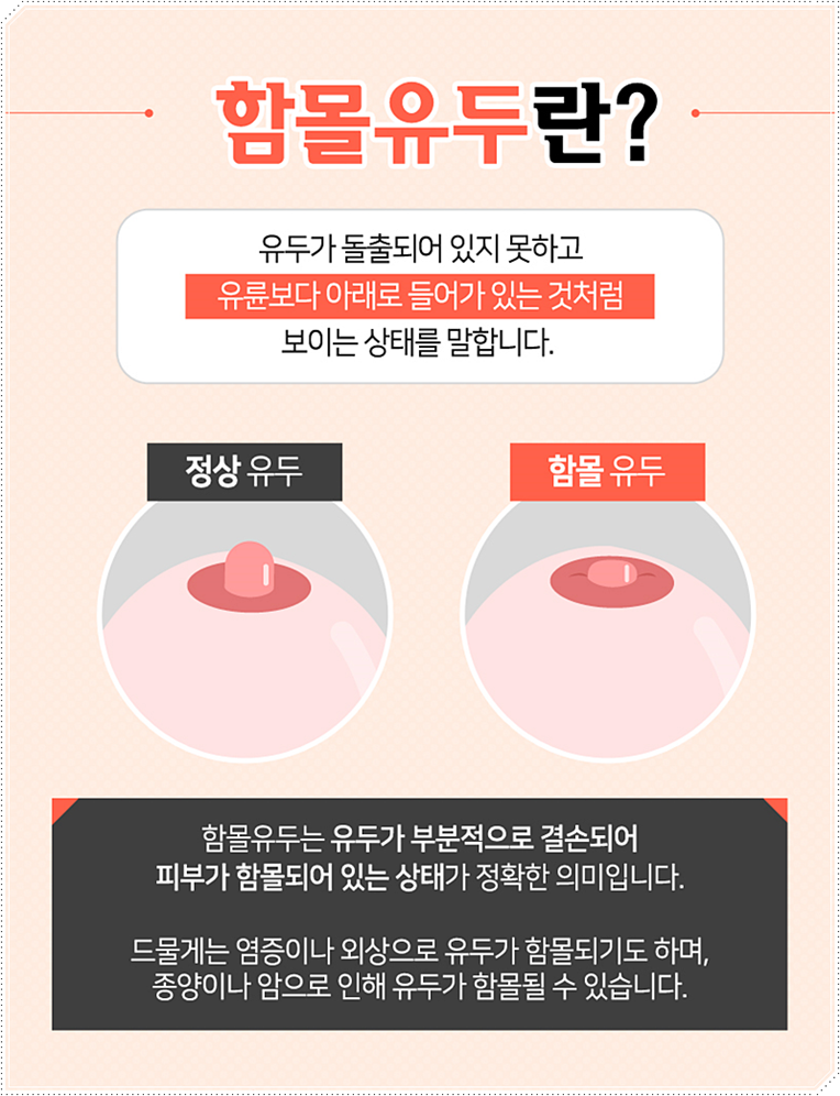 유두모양 사람에 따라 다르죠! 관련 이미지 2